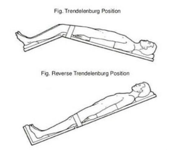 Trendelenburg Position vs Reverse Trendelenburg Position